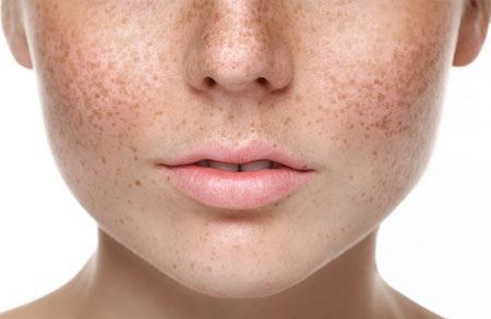 Picture for category Iho